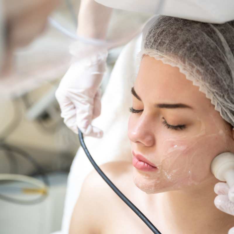 Why Do People Choose HIFU for a Non-Surgical Facelift? 5 What are the risks Trowbridge?